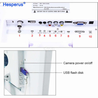 17 Inch Screen Dental Intra Oral Camera With Monitor Digital Intraoral Endoscope Camera Cmos Scanner Medical Equipment Oral