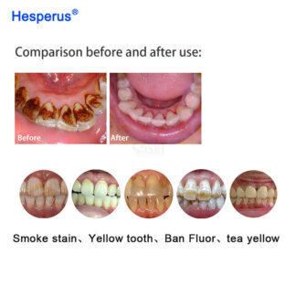 Dental Supplies Airflow Dental Air Prophy Jet Polisher Teeth Whitening Dental Air Polisher Prophy Mate Dental Sandblaster Metal