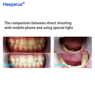 Hot Sale Dental Photography Led Flash Light Easy To Instal For Dentist Oral Cellphone Holder With Bluetooth Photo Lamp