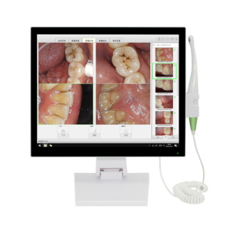 Dental Intra Oral Camera Scanner Wireless Wifi Endoscope All-in-one Hd 17 Inch Touch Screen Monitor Connect With Dental Chair