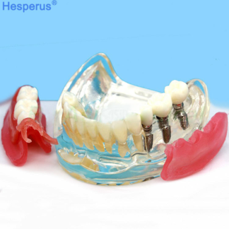 Dental Typodont Study Orthodontic Treatment Demonstration Teeth Model