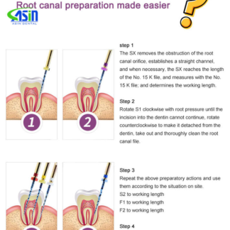 Dental Niti File Root Canal Files 25mm /21mm/19mm Assorted Endo Rotary Files Small Equipment